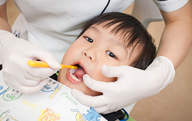 日本小児歯科学会専門医による子どもの歯科治療